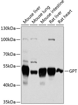 Anti-GPT Antibody (CAB2814)