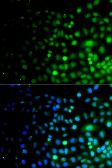 Anti-UBA6 Antibody (CAB7511)