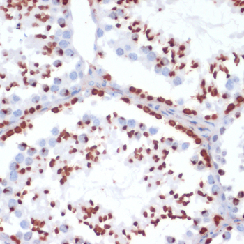 Anti-Phospho-Histone H2AFX-S139 Antibody (CABP0099)