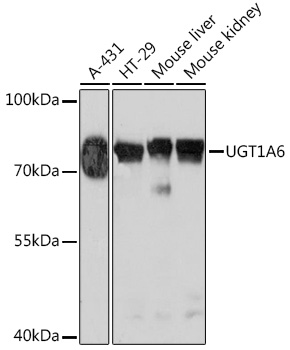 Anti-UGT1A6 Antibody (CAB17166)