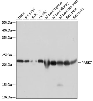 Anti-PARK7 Antibody (CAB19097)