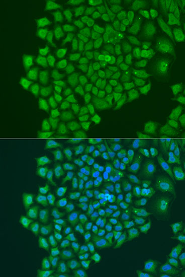 Anti-YBX1 Antibody (CAB15696)