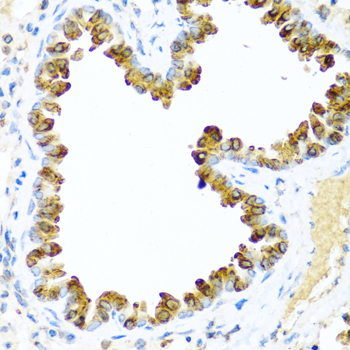 Anti-NRG4 Antibody (CAB2599)