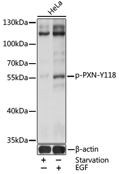 Anti-Phospho-Paxillin-Y118 Antibody (CABP0156)