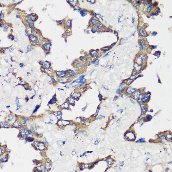 Anti-Cyclin B1 Antibody (CAB16038)