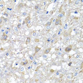 Anti-MTX1 Antibody (CAB7912)