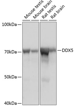 Anti-DDX5 Antibody