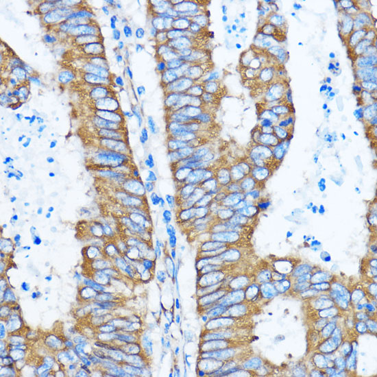 Anti-YBX1 Antibody [KO Validated] (CAB7704)