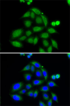 Anti-ELAC2 Antibody (CAB7128)