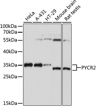 Anti-PYCR2 Antibody (CAB15155)