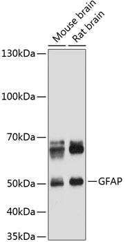 Anti-GFAP Mouse Monoclonal Antibody