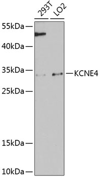 Anti-KCNE4 Antibody (CAB12184)