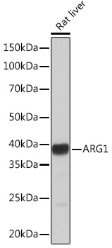 Anti-ARG1 Antibody (CAB4923)