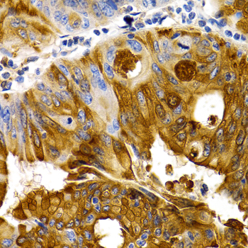 Anti-TFF1 Antibody (CAB1789)