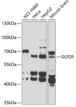 Anti-GLP2R Antibody (CAB6602)