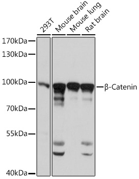 Anti-Beta-Catenin Antibody (CAB11932)