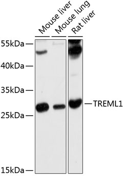 Anti-TREML1 Antibody (CAB10414)