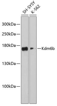 Anti-Kdm6b Antibody (CAB12763)