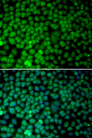 Anti-RBX1 Antibody (CAB1832)