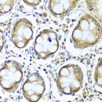 Anti-IFI44 Polyclonal Antibody (CAB8188)