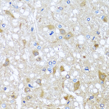 Anti-EFHC1 Polyclonal Antibody (CAB8002)