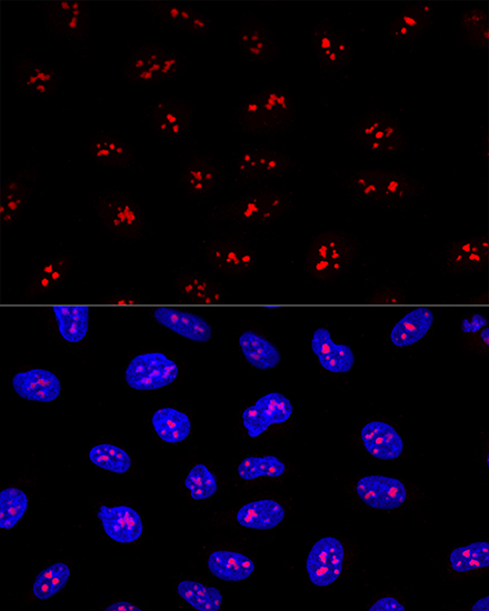 Anti-EBNA1BP2 Polyclonal Antibody (CAB9153)