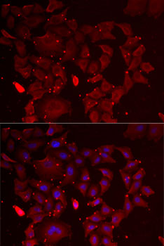 Anti-ADSS Antibody (CAB6516)