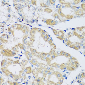 Anti-ATPIF1 Antibody (CAB5099)