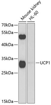 Anti-UCP1 Antibody (CAB5857)