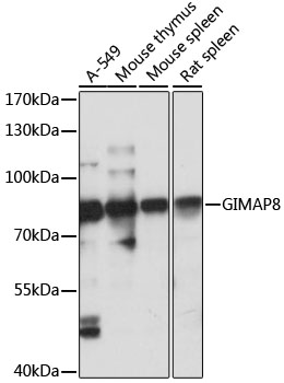 Anti-GIMAP8 Antibody (CAB15213)