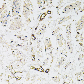 Anti-CD31/PECAM1 Antibody (CAB3181)