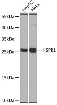 Anti-HSPB1 Antibody (CAB0240)