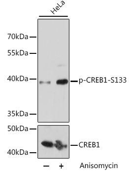 Anti-Phospho-CREB1-S133 Antibody (CABP0019)