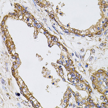 Anti-CAST Antibody (CAB0097)