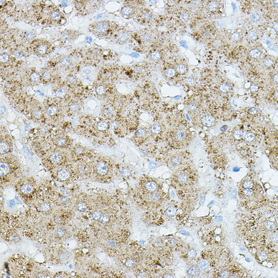 Anti-EIF2AK1 Antibody (CAB14119)