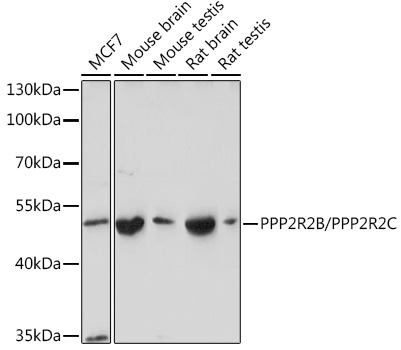 Anti-PPP2R2B/PPP2R2C Antibody (CAB18572)