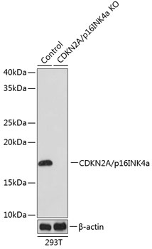 Anti-CDKN2A/p16INK4a[KO Validated] Antibody