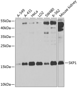 Anti-SKP1 Antibody (CAB2566)