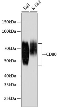 Anti-CD80 Antibody (CAB19025)