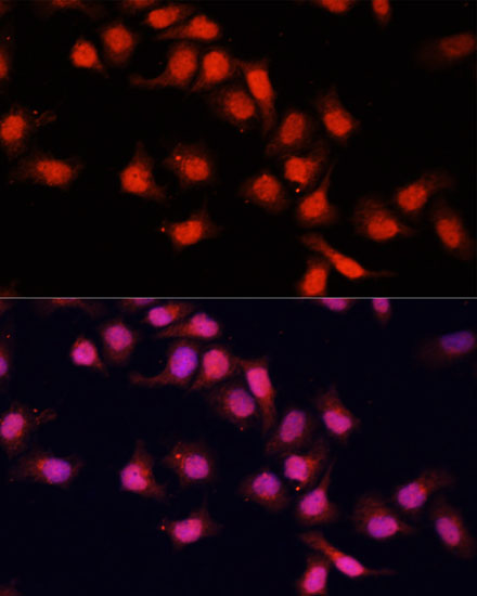 Anti-PRDM14 Antibody (CAB5543)