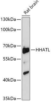 Anti-HHATL Antibody (CAB17739)