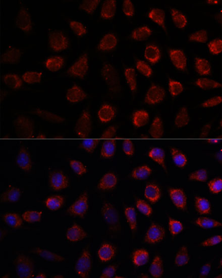 Anti-PDE11A Antibody (CAB16121)