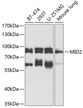 Anti-MID2 Polyclonal Antibody (CAB8325)