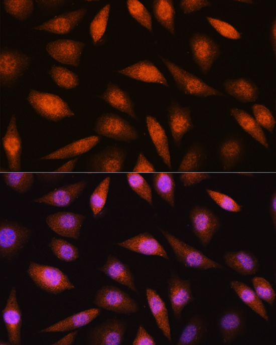 Anti-LIMK2 Antibody (CAB5409)