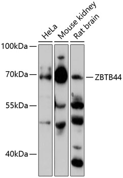 Anti-ZBTB44 Antibody (CAB13148)