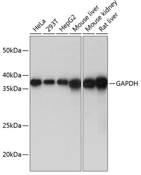 Anti-GAPDH Antibody (CAB19056)