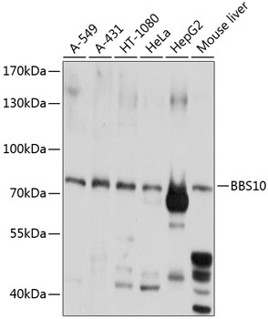 Anti-BBS10 Polyclonal Antibody (CAB8820)