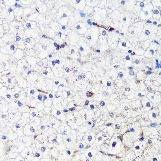 Anti-HO-1 Antibody (CAB11102)