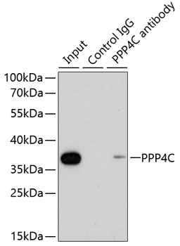 Anti-PPP4C Antibody (CAB13531)