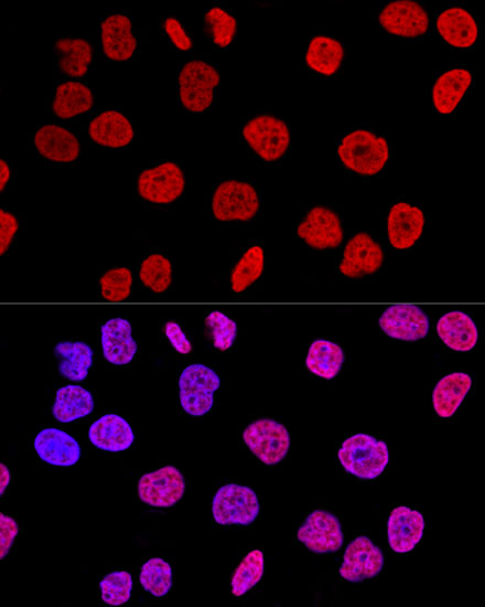 Anti-Histone H2AX Antibody (CAB11463)